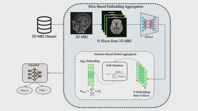 DinoAtten3D: Slice-Level Attention Aggregation of DinoV2 for 3D Brain MRI Anomaly Classification featured image