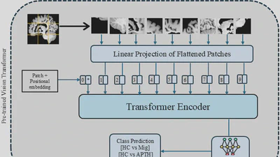 Leveraging multi-modal foundation model image encoders to enhance brain MRI-based headache classification featured image